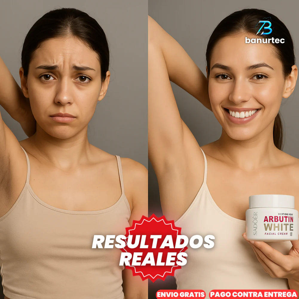 Oferta Especial: ArbutinWhite™ Crema Blanqueadora De Nicotinamida y Arbutina
