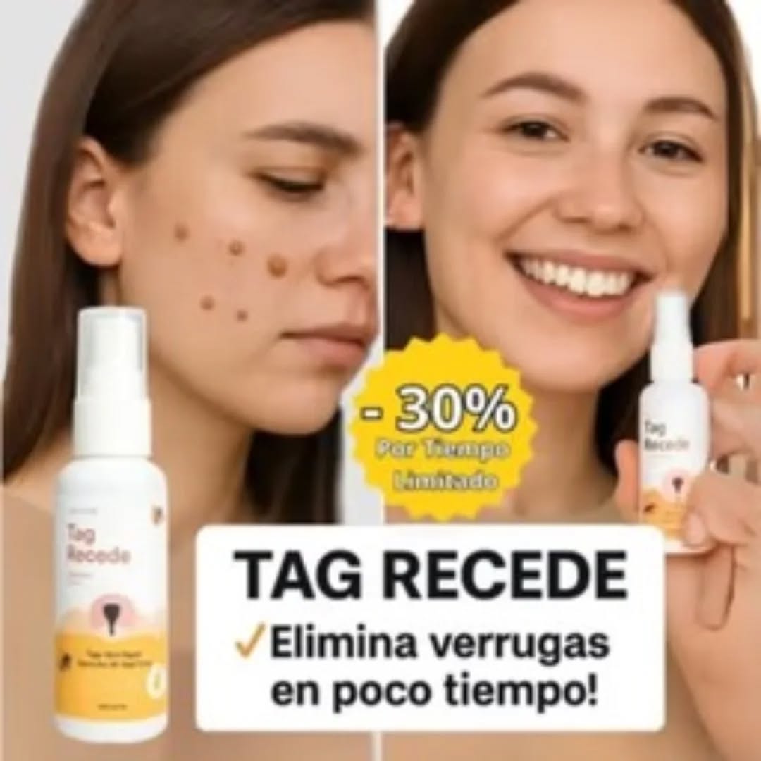 Tag Recede Eliminador de verrugas